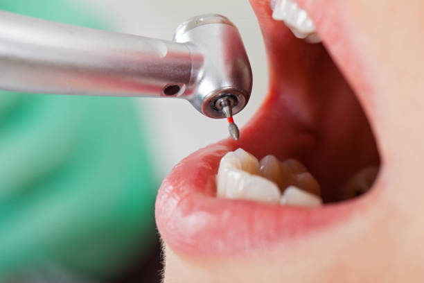 Best Weekend Emergency Dentist in Vinton, LA